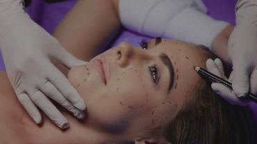 Volumização Facial Full Face com Hyaluron Pen