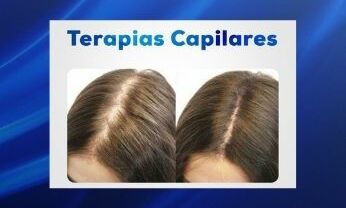 Terapias Capilares e Associações