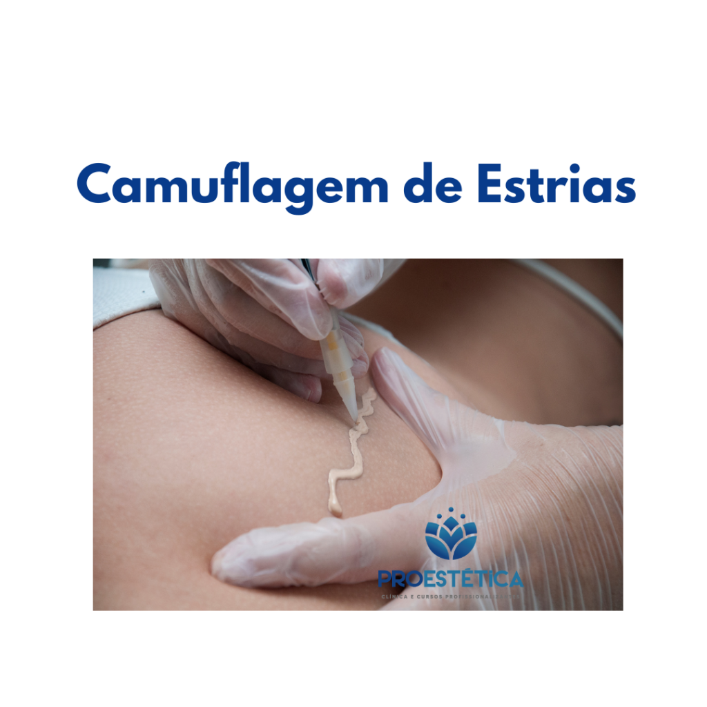 camuflagem de estrias