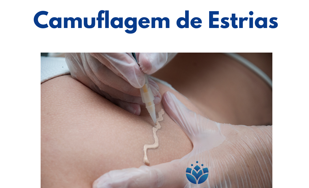 Camuflagem de Estrias