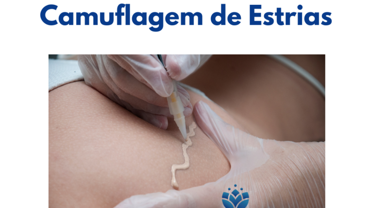 Camuflagem de Estrias
