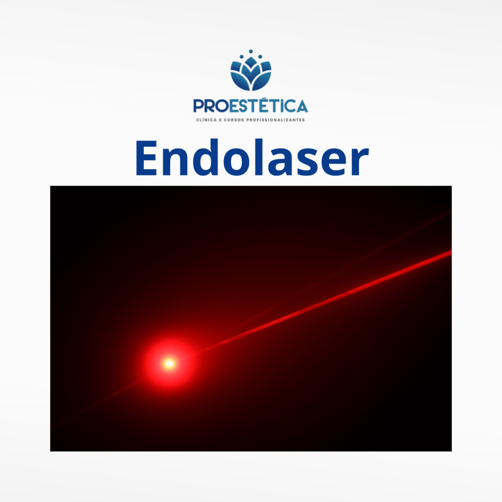 endolaser