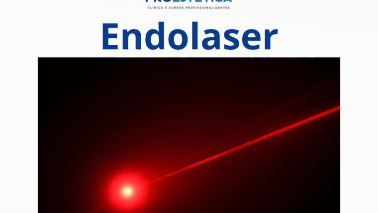 Endolaser Facial, Rejuvenescimento Sem Preenchimento